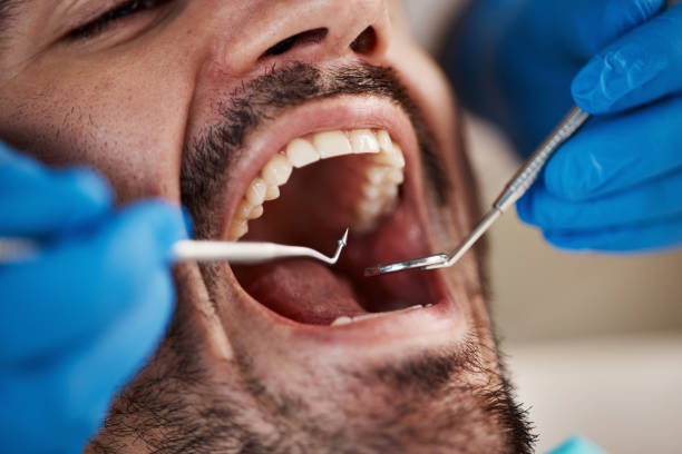 Best Emergency Dental Care for Sports Injuries in Copperas Cove, TX